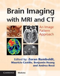 Abbildung von: Brain Imaging with MRI and CT - Cambridge University Press