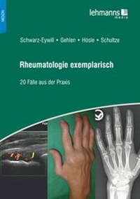 Abbildung von: Rheumatologie exemplarisch - Lehmanns Media