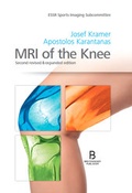 Cover: MRI of the Knee - Breitenseher Publisher