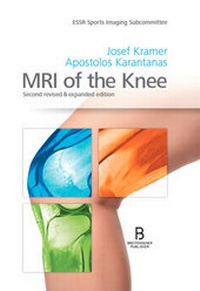 Enlarge image Cover: MRI of the Knee - Breitenseher Publisher