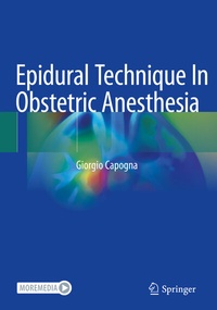 Abbildung von: Epidural Technique In Obstetric Anesthesia - Springer