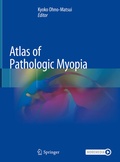 Cover: Atlas of Pathologic Myopia - Springer