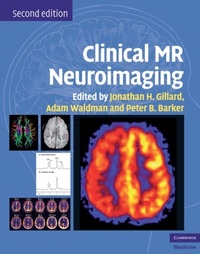 Abbildung von: Clinical MR Neuroimaging - Cambridge University Press