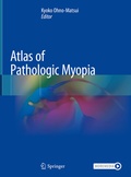 Cover: Atlas of Pathologic Myopia - Springer