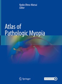 Enlarge image Cover: Atlas of Pathologic Myopia - Springer