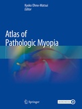 Cover: Atlas of Pathologic Myopia - Springer
