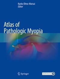 Enlarge image Cover: Atlas of Pathologic Myopia - Springer