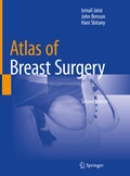 Cover: Atlas of Breast Surgery - Springer