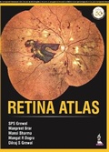 Cover: Retina Atlas - Jaypee Brothers Medical Publishers