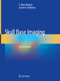 Abbildung von: Skull Base Imaging - Springer