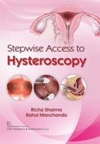 Enlarge image Cover: Stepwise Access to Hysteroscopy - CBS Publishers and Distributors Private Limited