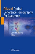 Cover: Atlas of Optical Coherence Tomography for Glaucoma - Springer