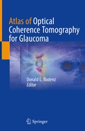 Cover: Atlas of Optical Coherence Tomography for Glaucoma - Springer