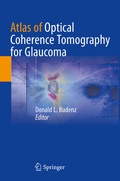 Cover: Atlas of Optical Coherence Tomography for Glaucoma - Springer