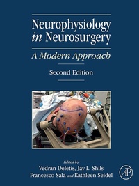 Abbildung von: Neurophysiology in Neurosurgery - Academic Press