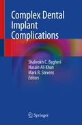 Cover: Complex Dental Implant Complications - Springer