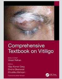 Abbildung von: Comprehensive Textbook on Vitiligo - CRC Press