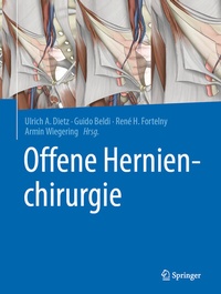 Abbildung von: Offene Hernienchirurgie - Springer