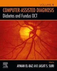 Abbildung von: Diabetes and Fundus OCT - Elsevier