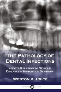 Abbildung von: The Pathology of Dental Infections - Pantianos Classics