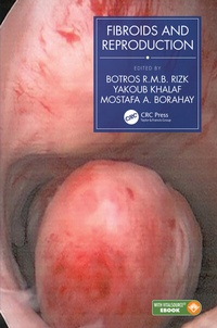 Enlarge image Cover: Fibroids and Reproduction - CRC Press