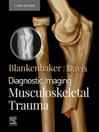 Abbildung von: Diagnostic Imaging: Musculoskeletal Trauma,E-Book - Elsevier