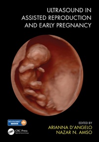 Abbildung von: Ultrasound in Assisted Reproduction and Early Pregnancy - CRC Press