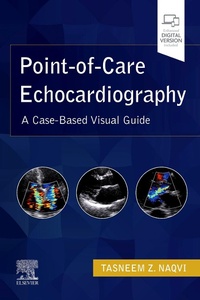 Bild: Point-of-Care Echocardiography - Elsevier