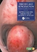 Cover: Fibroids and Reproduction - CRC Press