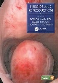 Enlarge image Cover: Fibroids and Reproduction - CRC Press