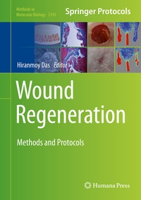 Abbildung von: Wound Regeneration - Humana