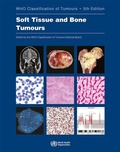 Cover: WHO classification of tumours of soft tissue and bone tumours - IARC
