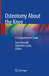 Abbildung von: Osteotomy About the Knee - Springer