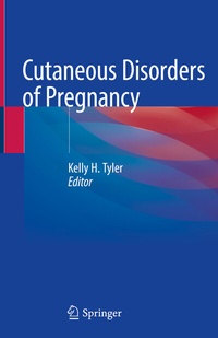 Abbildung von: Cutaneous Disorders of Pregnancy - Springer