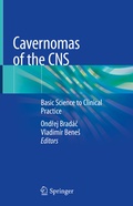 Abbildung von: Cavernomas of the CNS - Springer