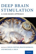 Cover: Deep Brain Stimulation - Oxford University Press Inc