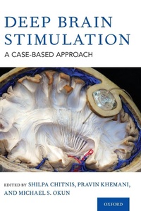 Enlarge image Cover: Deep Brain Stimulation - Oxford University Press Inc