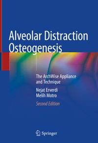 Abbildung von: Alveolar Distraction Osteogenesis - Springer