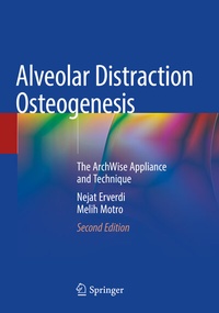 Abbildung von: Alveolar Distraction Osteogenesis - Springer