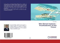 Abbildung von: Mini Dental Implants : Prosthodontics of the Future - LAP Lambert Academic Publishing