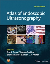 Abbildung von: Atlas of Endoscopic Ultrasonography - Wiley-Scrivener