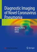 Cover: Diagnostic Imaging of Novel Coronavirus Pneumonia - Springer