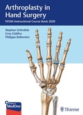 Cover: Arthroplasty in Hand Surgery - Thieme