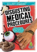 Cover: Disgusting Medical Procedures - Kaleidoscope Publishing, Inc