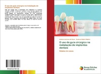 Abbildung von: O uso de guia cirurgico na instalacao de implantes dentais - Novas Edicoes Academicas