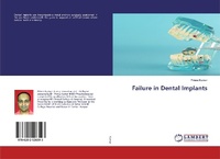 Enlarge image Cover: Failure in Dental Implants - LAP Lambert Academic Publishing