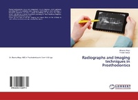 Abbildung von: Radiographs and Imaging techniques in Prosthodontics - LAP Lambert Academic Publishing