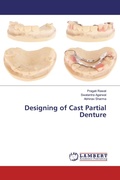 Cover: Designing of Cast Partial Denture - LAP Lambert Academic Publishing