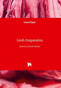 Enlarge image Cover: Limb Amputation - IntechOpen