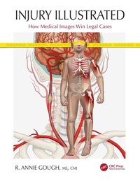 Abbildung von: Injury Illustrated - CRC Press
